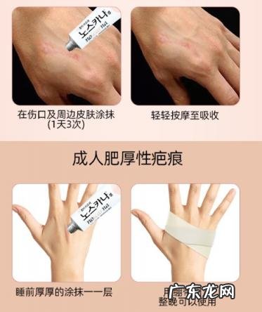 韩国noscarna疤痕使用说明书 noscarna祛疤膏怎么样