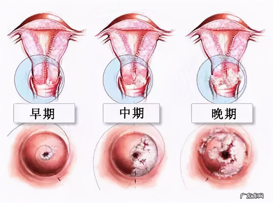 同房后少量出血是怎么了 同房后出血是什么原因造成的