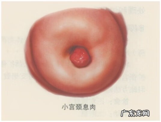 同房后少量出血是怎么了 同房后出血是什么原因造成的