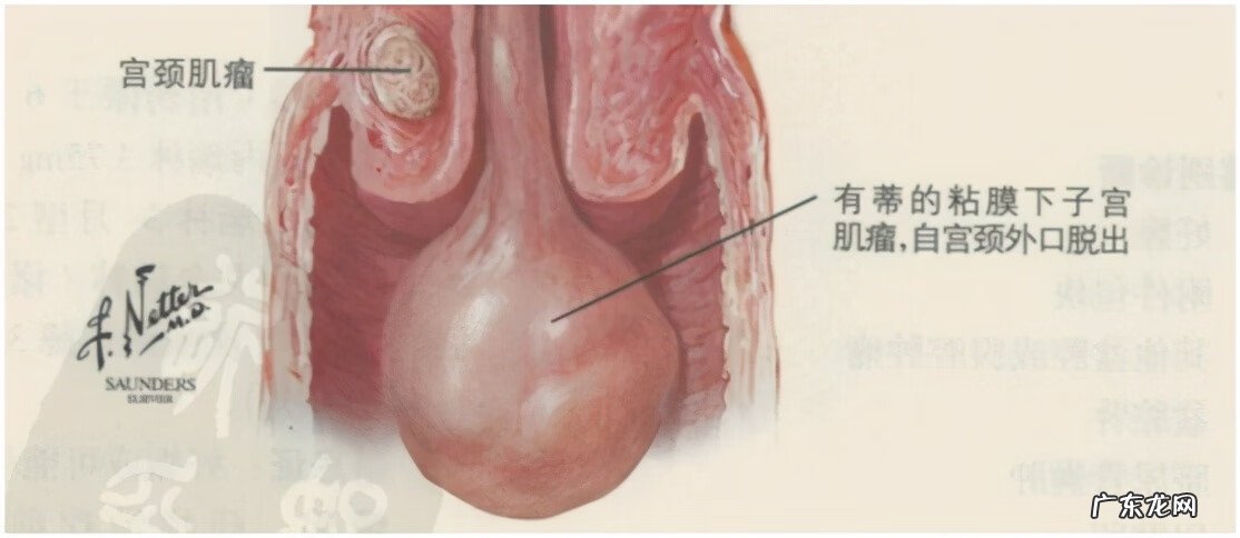 同房后少量出血是怎么了 同房后出血是什么原因造成的