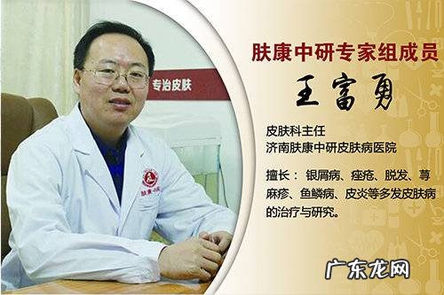 脸颊部黄褐斑 脸长黄褐斑的原因