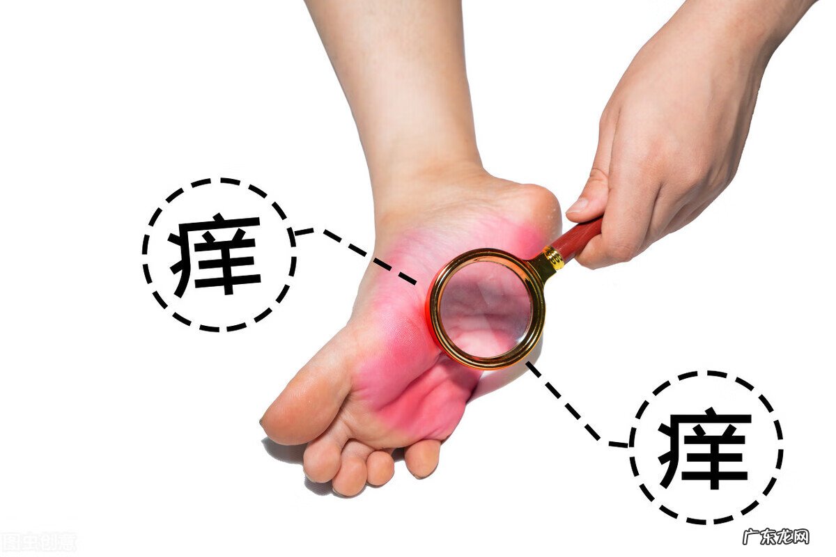 改善鸡皮肤的药 治疗鸡皮肤的药