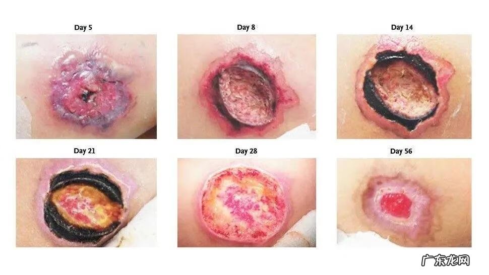 逆位隐士 黑隐士蜘蛛