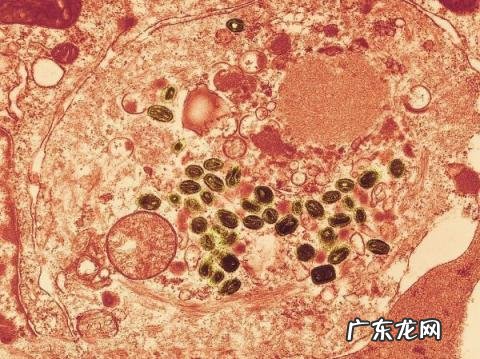 人类历史上的十大瘟疫书籍 人类史上三大瘟疫