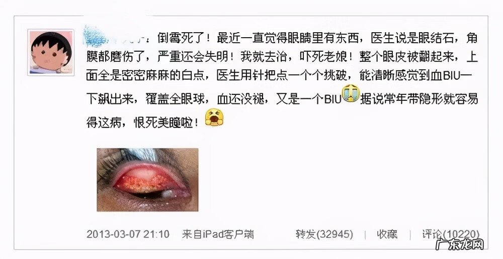 美瞳的基础知识 什么是美瞳眼睛