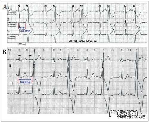 气脉短是什么原因 气脉短什么原因