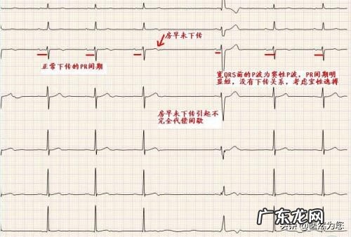 气脉短是什么原因 气脉短什么原因