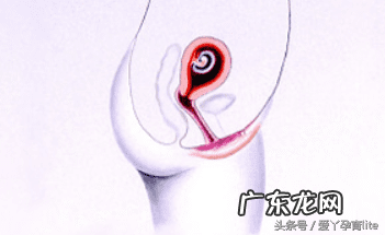 子宫只有2.5厘米正常吗 十厘米能到子宫吗