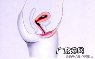 子宫只有2.5厘米正常吗 十厘米能到子宫吗