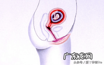 子宫只有2.5厘米正常吗 十厘米能到子宫吗