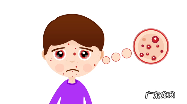 下巴长痘是什么原因造成的 下巴长痘痘是什么原因引起的