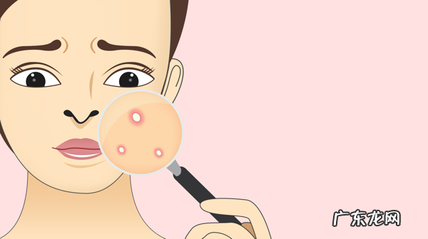下巴长痘是什么原因造成的 下巴长痘痘是什么原因引起的