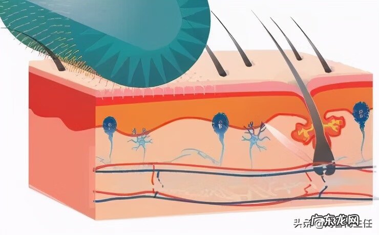 治疗痘坑最有效的方法是什么 有痘坑怎么办啊