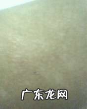 皮肤突然有一块变白头发变白 脸上的皮肤突然白了一块怎么回事