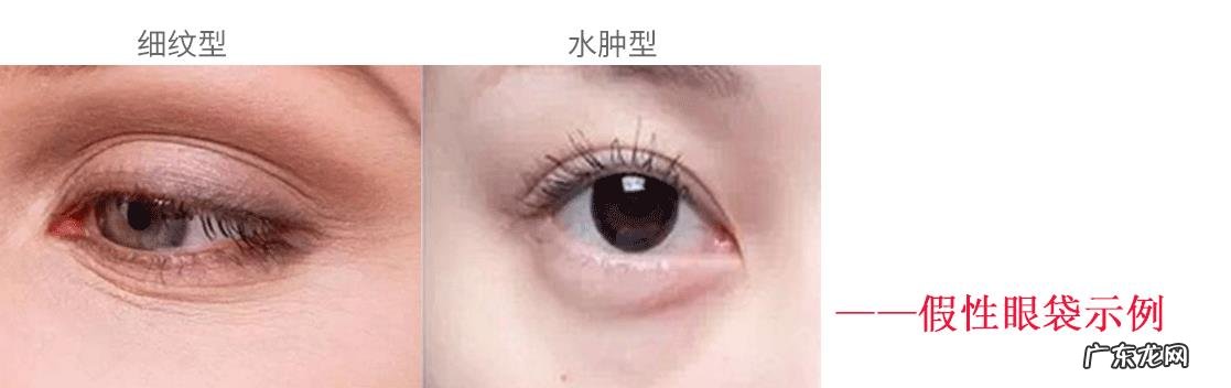 去除眼袋有哪些好办法呢?