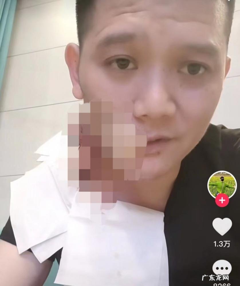 又一女歌手患癌身亡，36岁歌手傅松因口腔癌去世