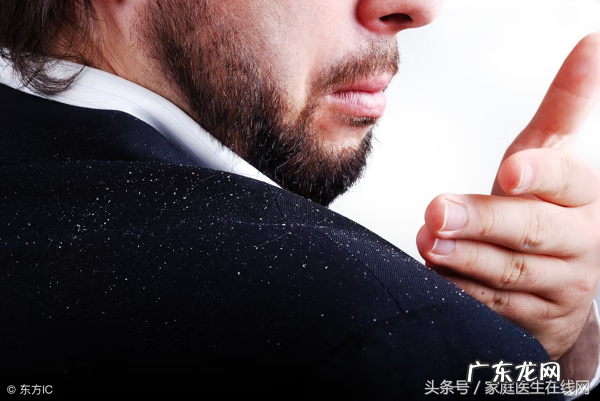 头皮屑太多怎么弄 头皮屑多怎么办呢