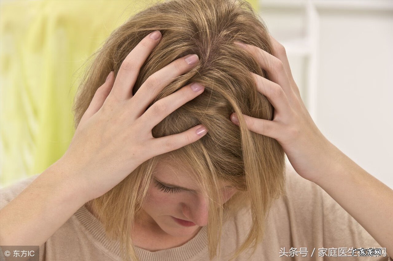 头皮屑太多怎么弄 头皮屑多怎么办呢