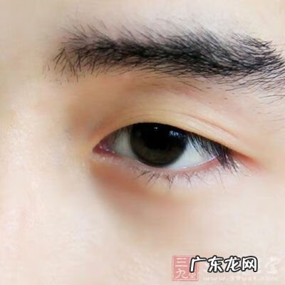 白化病属于什么病 白化病是什么病?