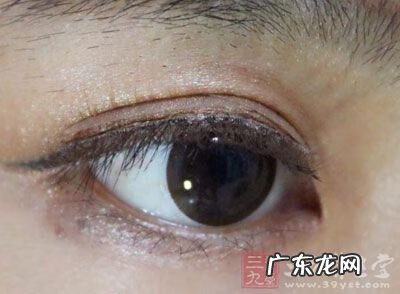 白化病属于什么病 白化病是什么病?