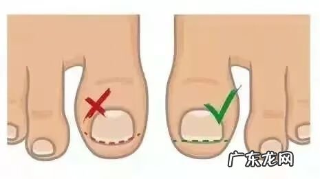 大脚趾头很大肉很多 大脚趾有肉