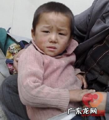 乞讨儿童被致残,儿童乞丐最惨图片