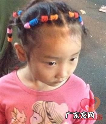 乞讨儿童被致残,儿童乞丐最惨图片