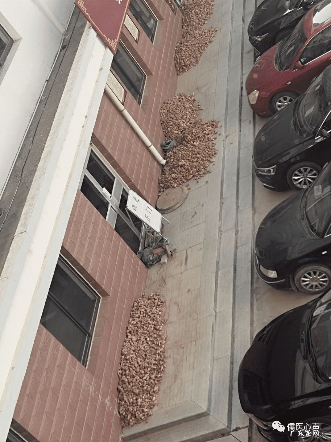 虎口按压酸痛是肾虚吗 虎口肉变薄代表什么