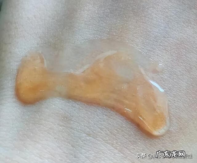 皮肤为什么那么干燥 皮肤干燥的原因有哪些