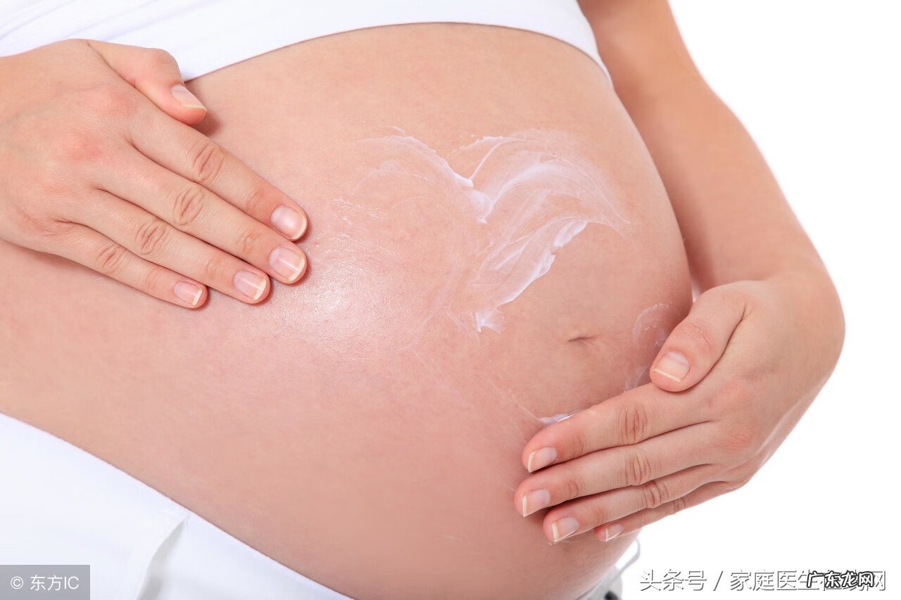 孕妇怎样预防妊娠纹 如何防止妊娠纹吗