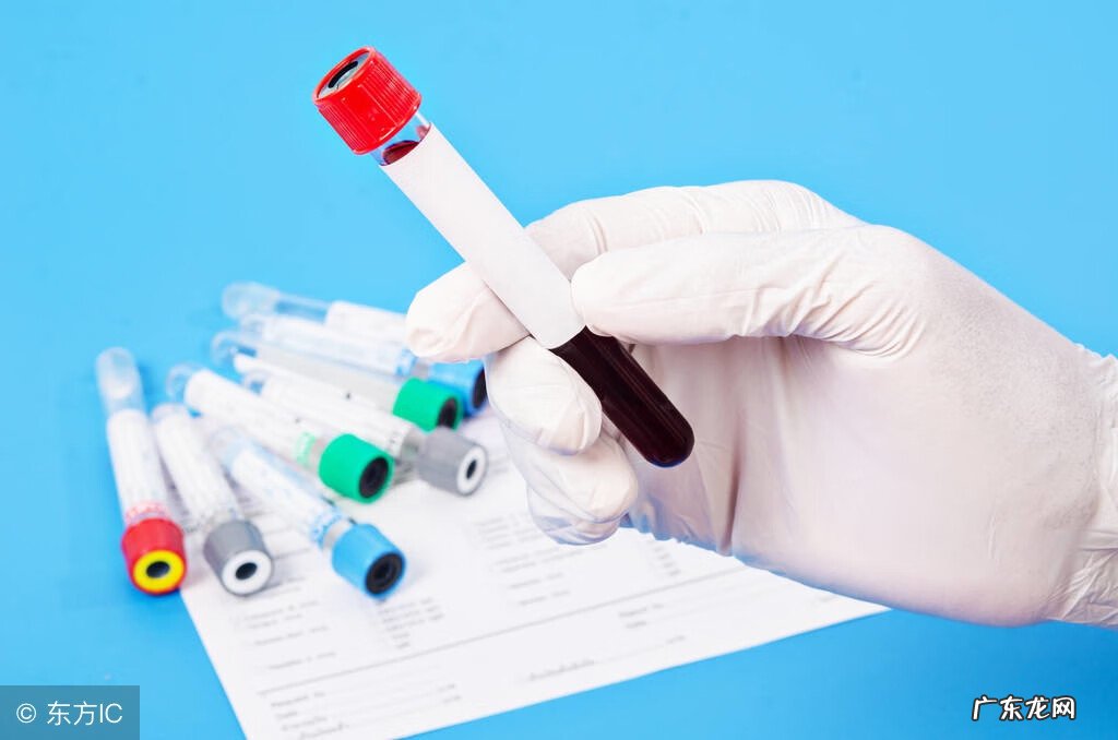 唐氏筛查检查需要空腹吗 做唐氏筛查需要空腹吗