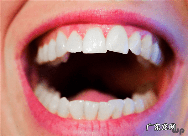 一扣牙缝就出血是什么原因 牙缝出血咋回事呀