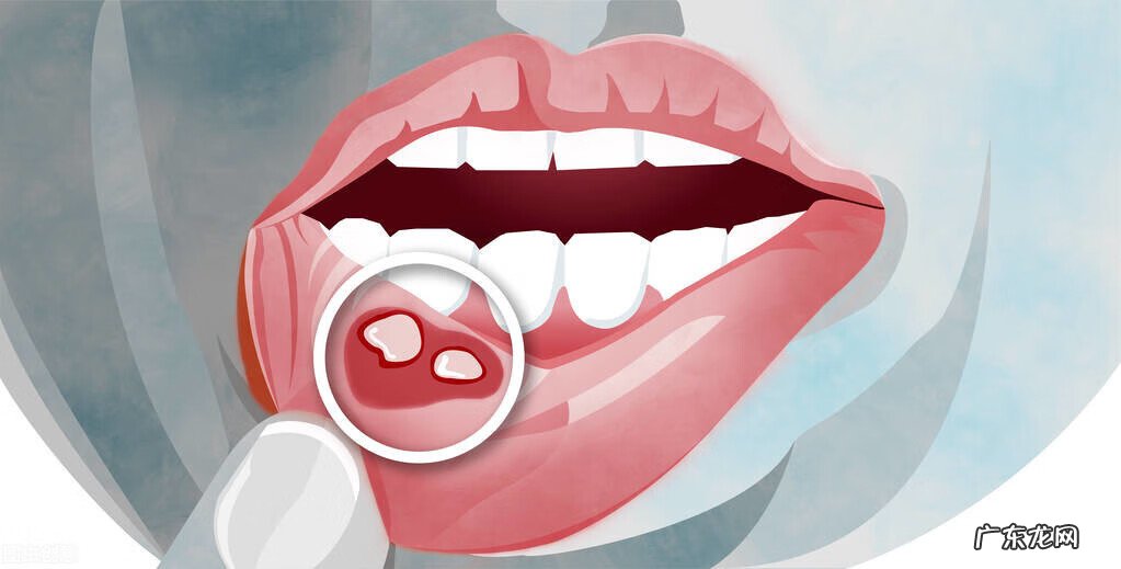 维生素b族缺乏八大症状 缺乏维生素b2的症状是什么