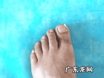 甲沟炎怎么自己治疗 甲沟炎治疗方法