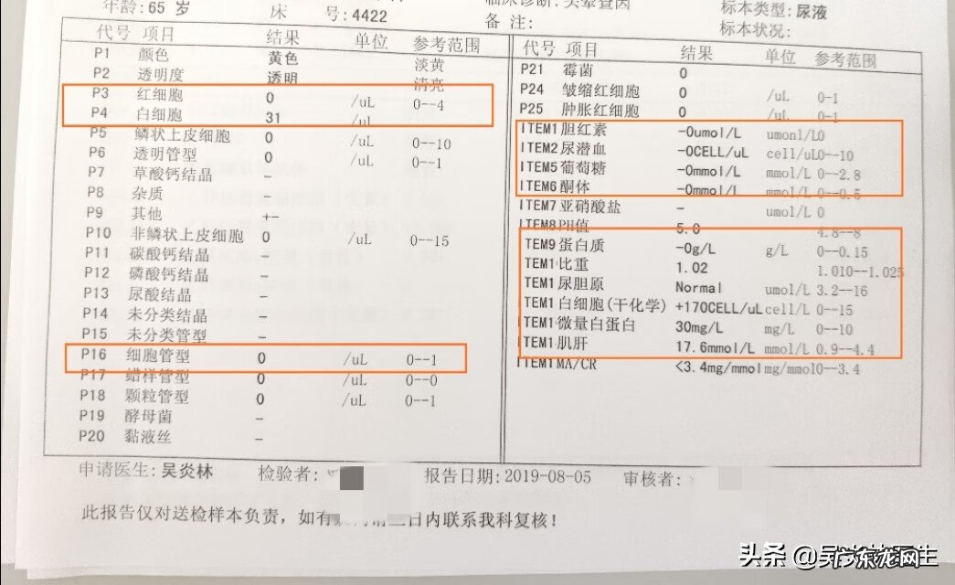 肝功能12项检查多少钱 检查肝功能需要多少钱
