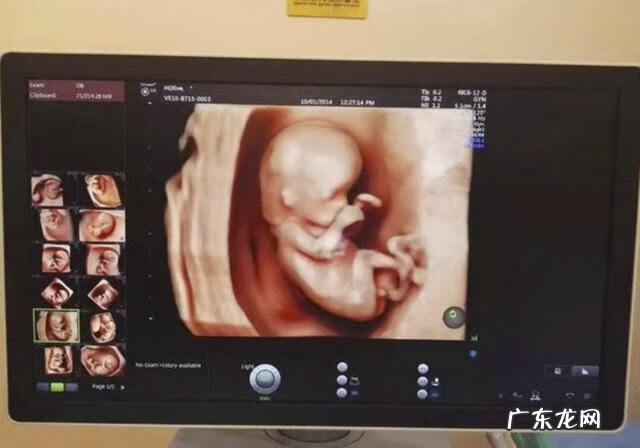 四维检查时间 四维检查