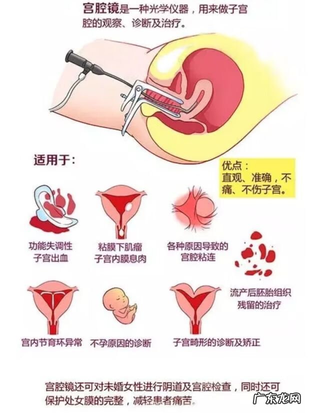 宫腔镜手术多少钱 宫腔镜手术是干什么的