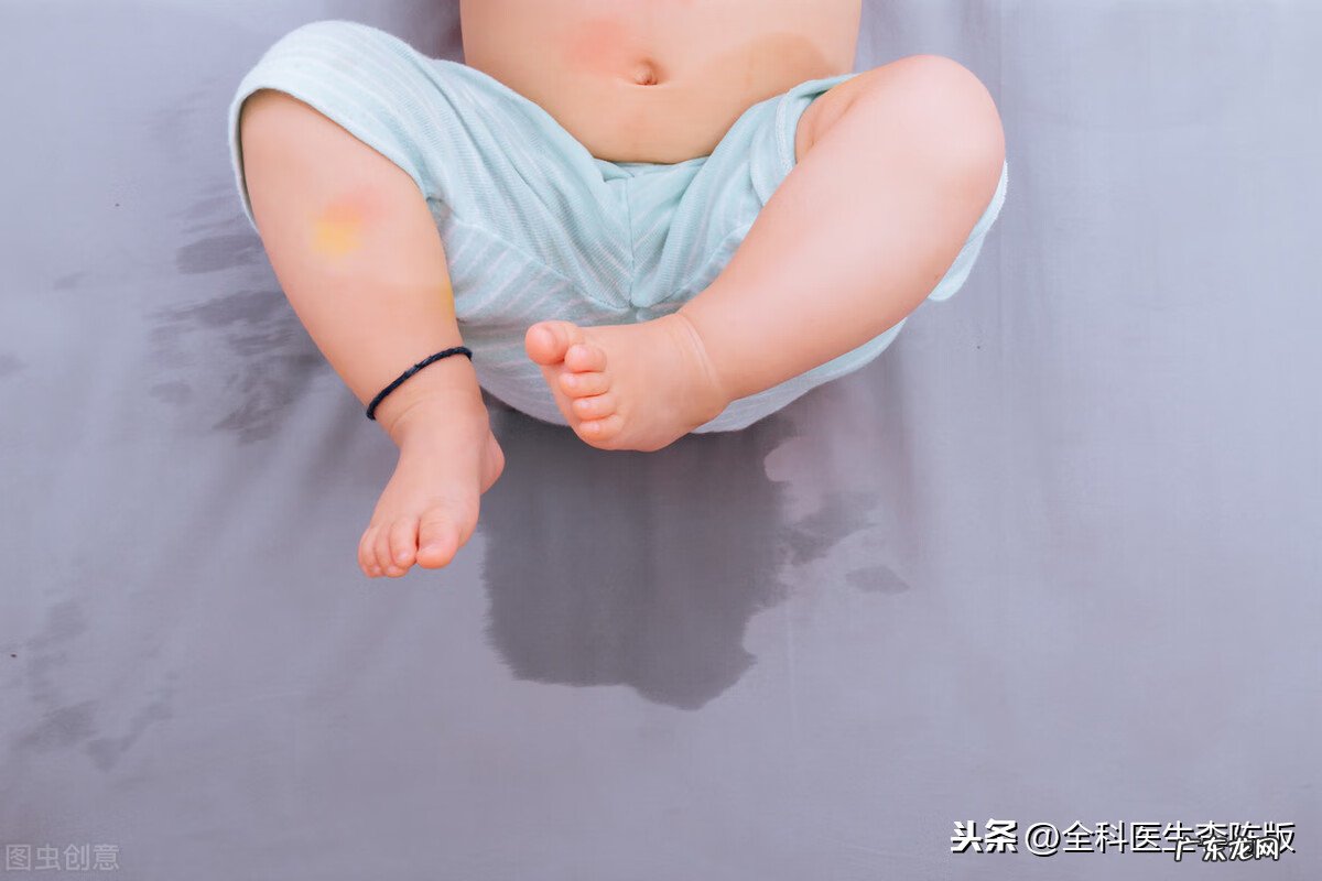 小孩遗尿怎么治疗 小孩遗尿怎么办