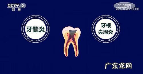 龋齿是怎么引起的 龋齿的形成过程