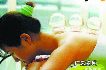 拔罐减肥有何害处 拔火罐减肥有什么坏处