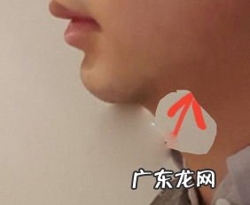 喉咙卡鱼刺感觉一会痛一会不痛 喉咙一侧痛像卡了鱼刺,痛了半年了