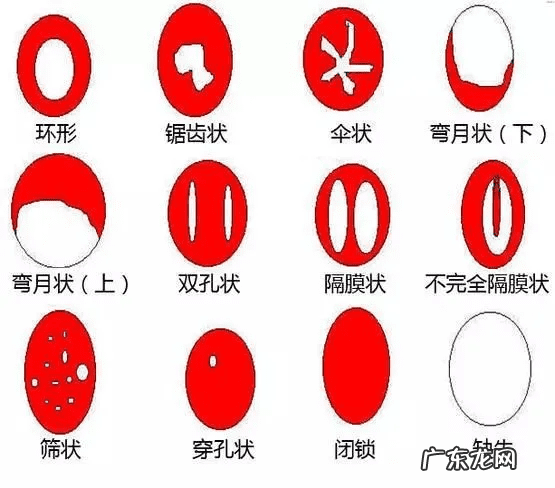 使用人造膜会被发现吗 人造处女膜