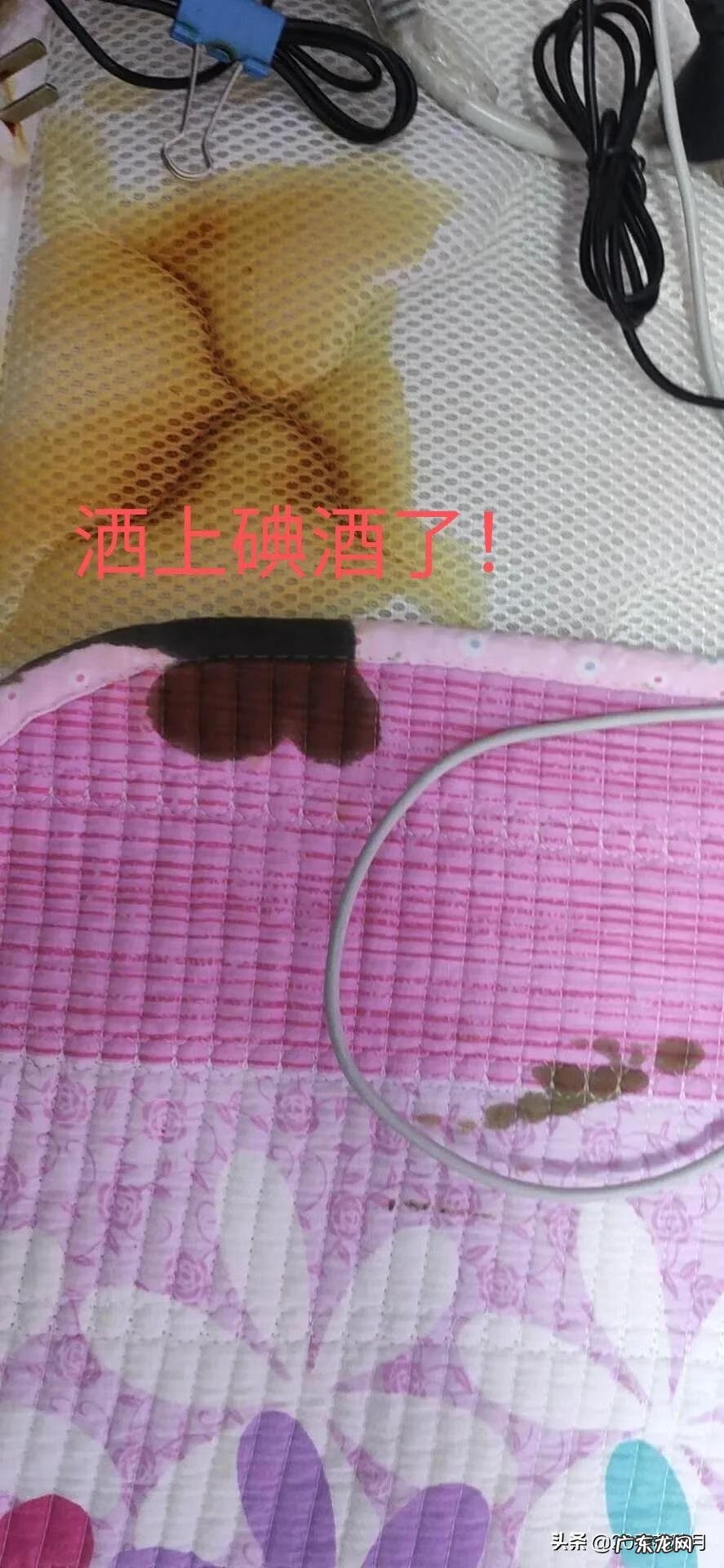 碘酒的黄印子怎么洗 碘酒怎么洗得掉