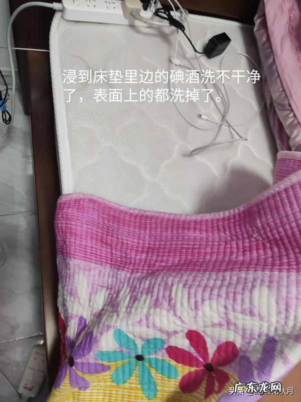 碘酒的黄印子怎么洗 碘酒怎么洗得掉
