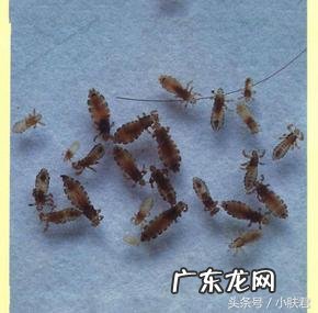 突然长虱子是什么原因 为什么会长虱子的原因