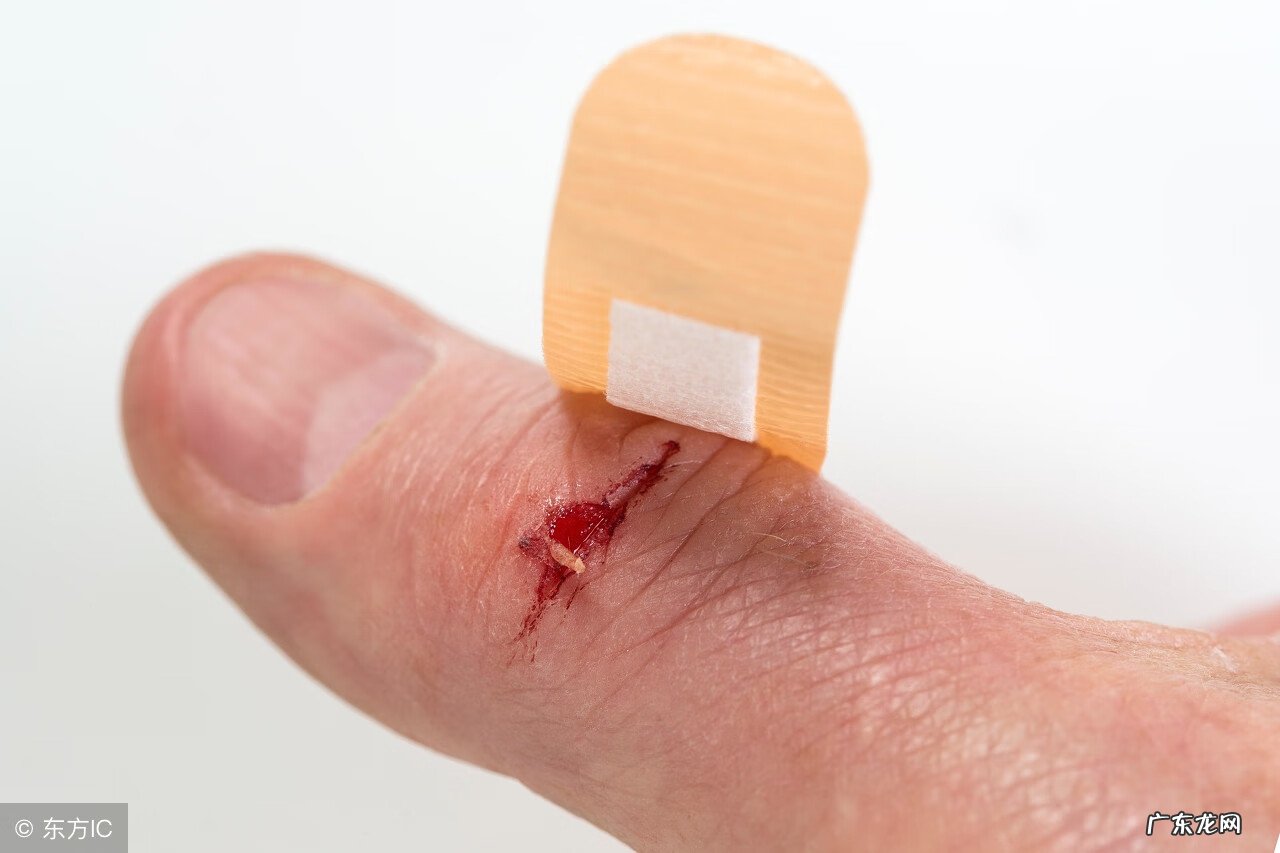 月经止血的药物都有哪些 月经止血药都有哪些