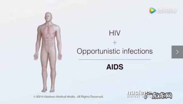 女性艾滋病 爱滋病