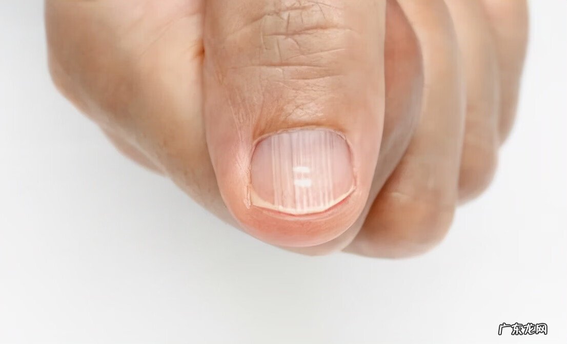 脚指甲增生变厚怎么样治疗 脚指甲变厚该怎么办