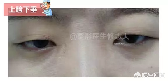 单眼皮好看的特征是什么?