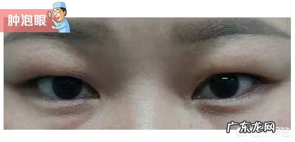 单眼皮好看的特征是什么?